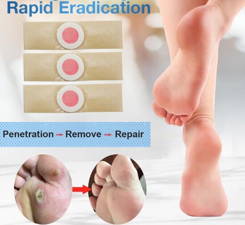Corn Foot Plaster Medical Plaster Plasters Removal Plantar Warts Pain Calluses