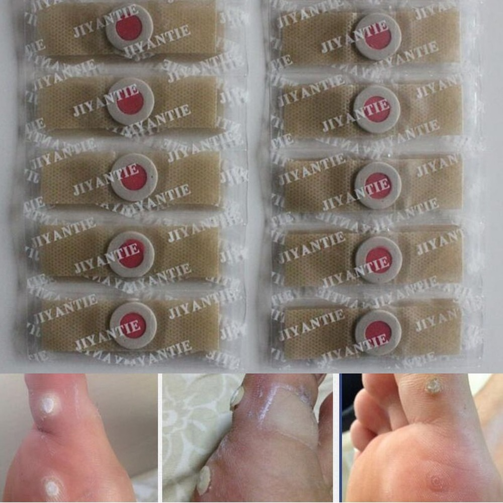 Corn Foot Plaster Medical Plaster Plasters Removal Plantar Warts Pain Calluses