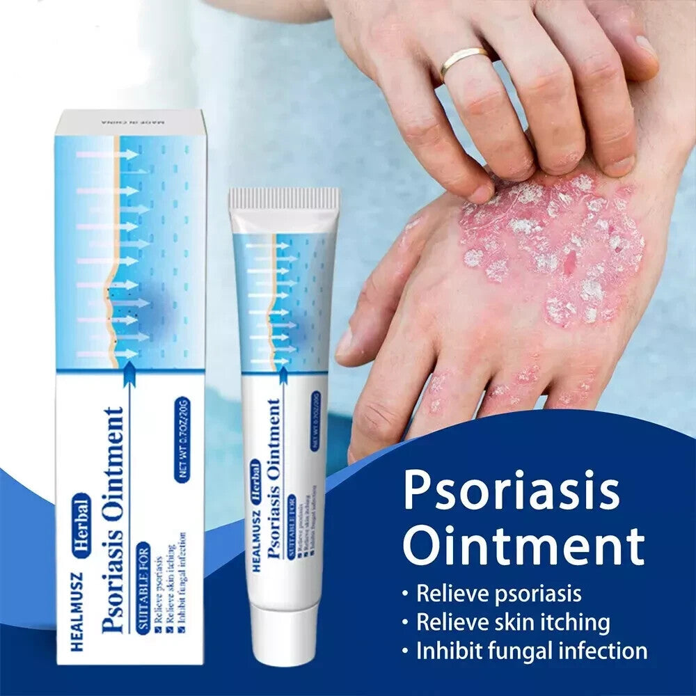 Psoriasis Cream for Dermatitis Eczematoid Eczema Natural Treatment Skin Ointment