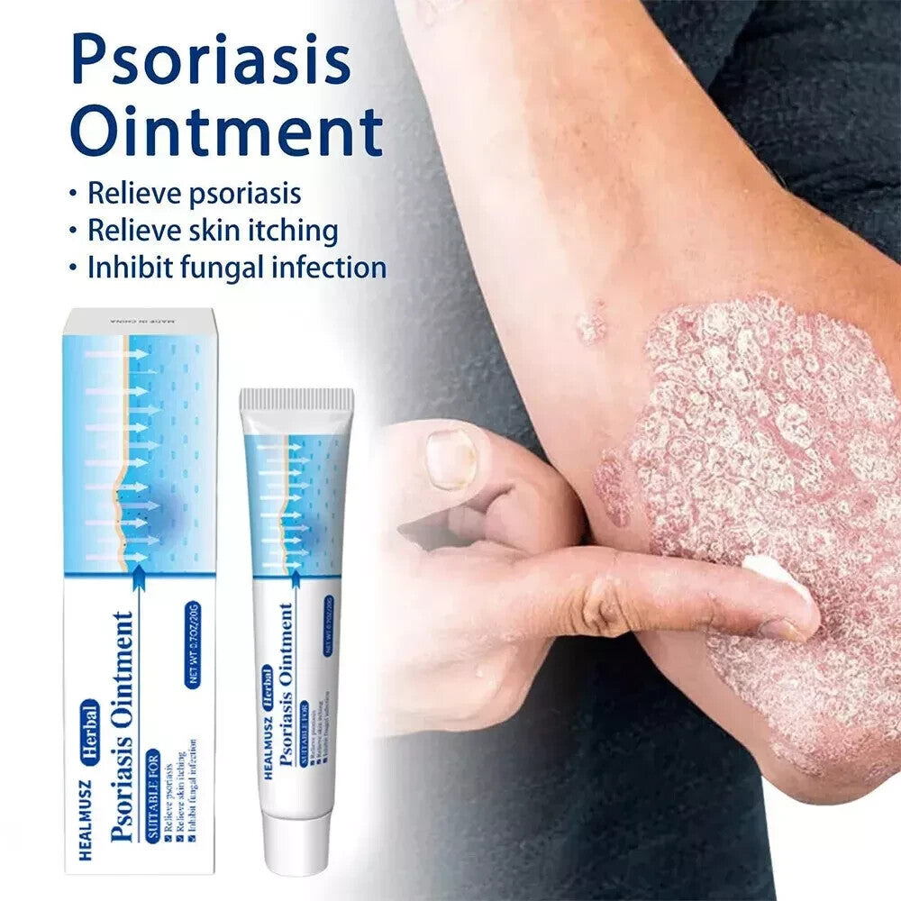 Psoriasis Cream for Dermatitis Eczematoid Eczema Natural Treatment Skin Ointment