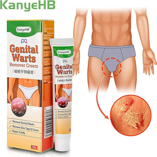 Genital Herpes Wart Remover Ointment Treatment Cream Skin Tag Corn Acuminatum UK